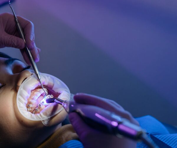 Ortodonta na NFZ. Dlaczego warto korzystać z jego usług?
